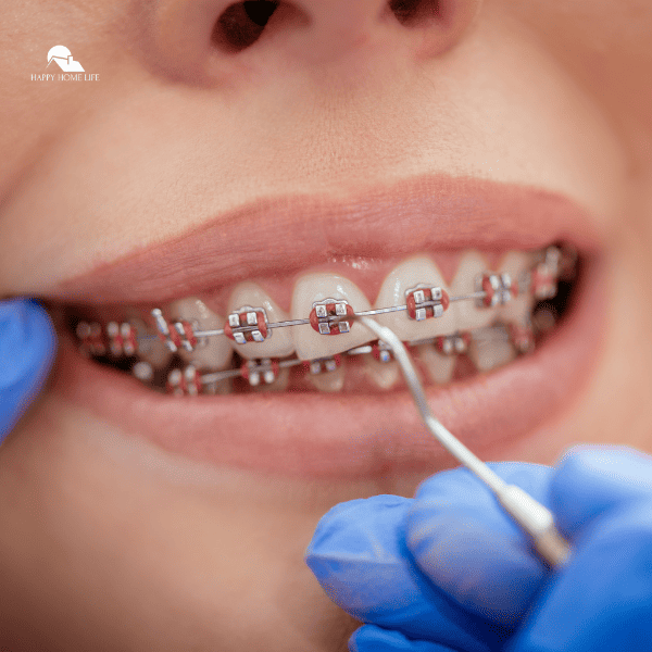 dentist checking female patient's bracket of the Braces